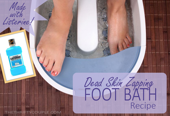 DIY Dead Skin Zapping Foot Bath Recipe 